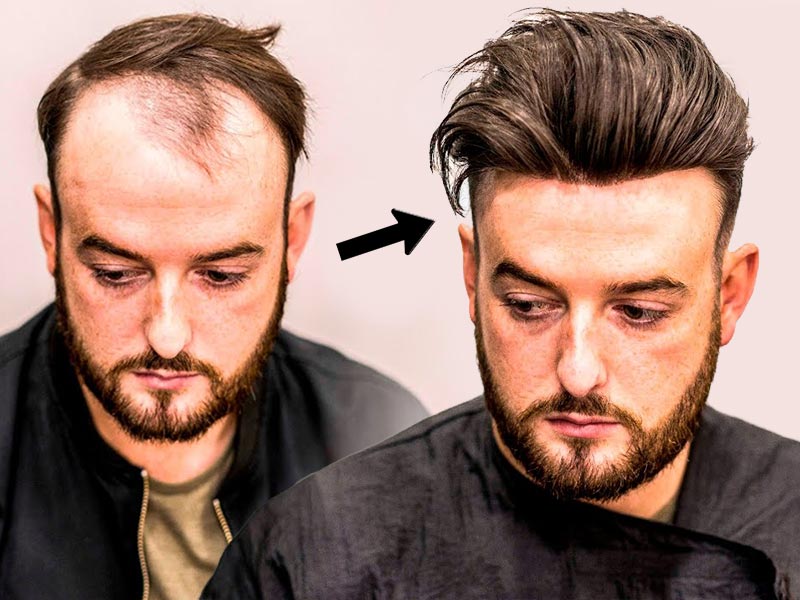 najlepszy przewodnik, Jak zrobić Toupee DIY | Lewigs