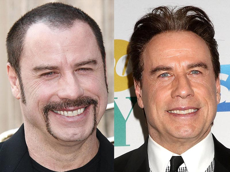 Celebrity Toupee: 12 Male Stars With 