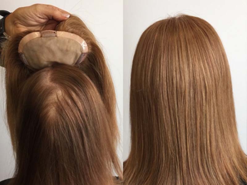 Hair Topper Before And After: Look At Its Pros And Cons!