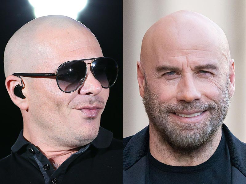 9+ Best Male Pattern Baldness Hairstyles & Haircuts To Try This Year