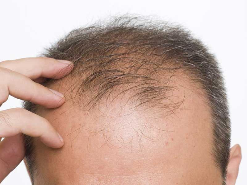 How To Grow Hair Faster Men? - The Next Big Thing