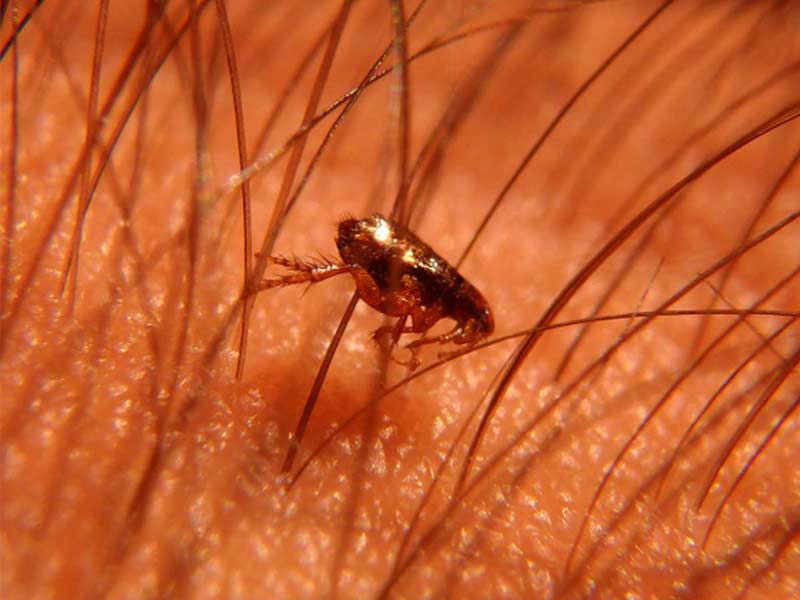 can cat fleas live in human hair