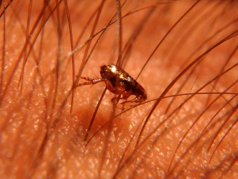 can cat lice live in human hair Jenise Salinas