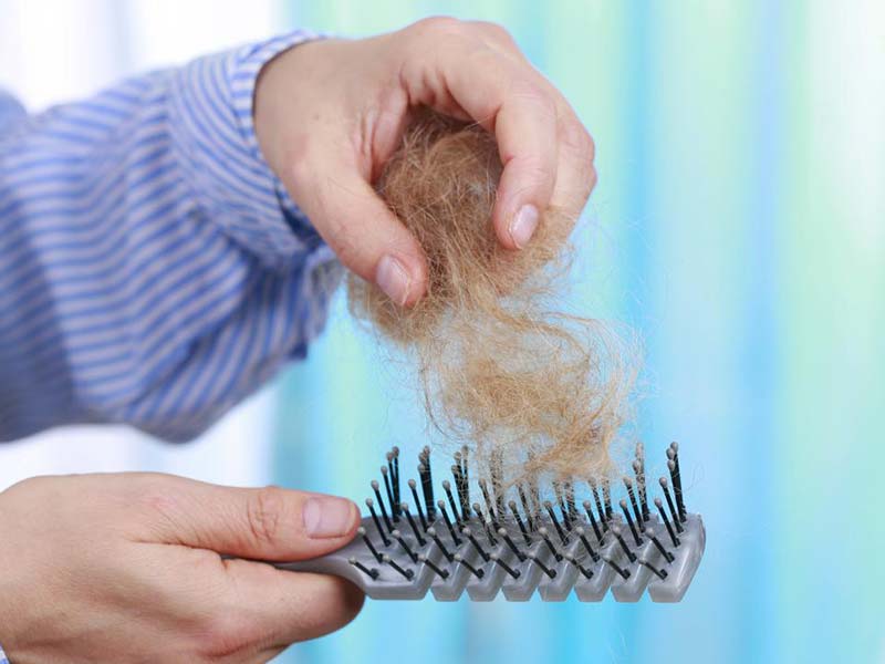 How Much Hair Loss Is Normal These Statistics Are Real