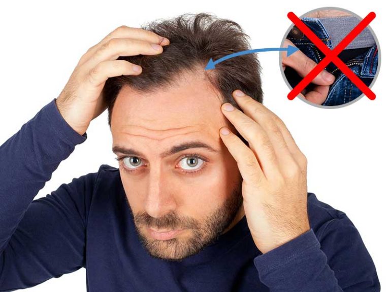 Pin on hair loss