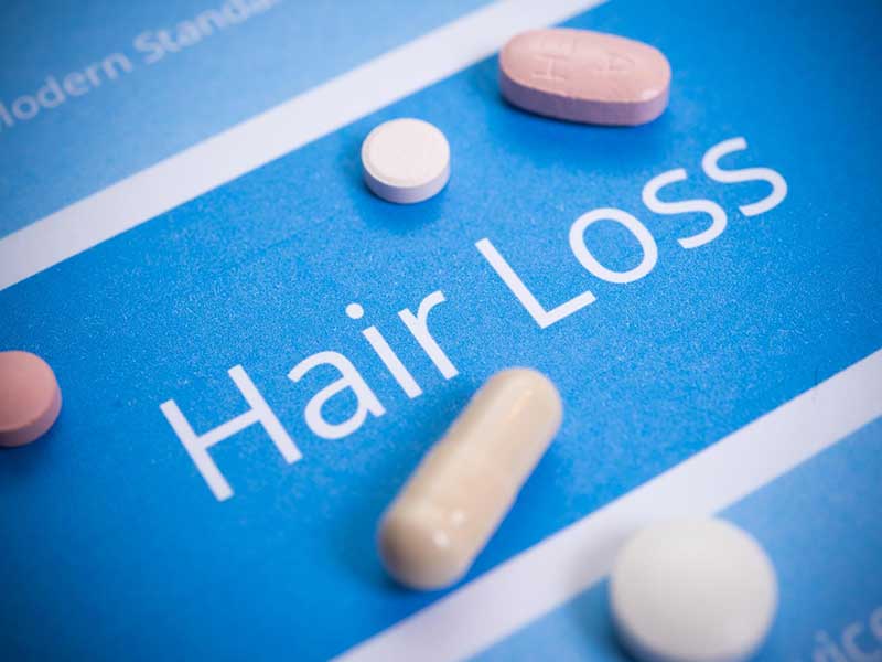 How To Reverse Hair Loss From Medication: The Easy Way Out