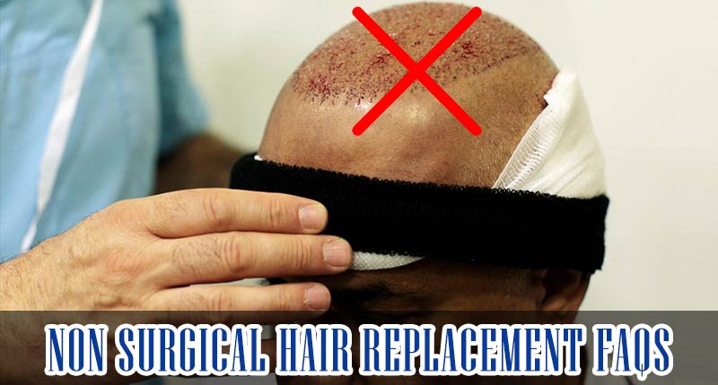 Non Surgical Hair Replacement - It Never Fails, Unless...