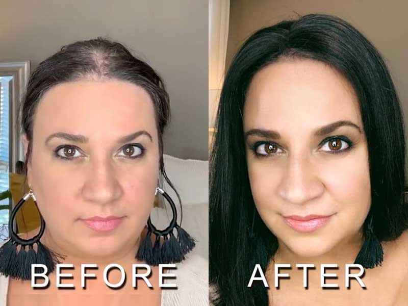 Non Surgical Hair Replacement - It Never Fails, Unless...