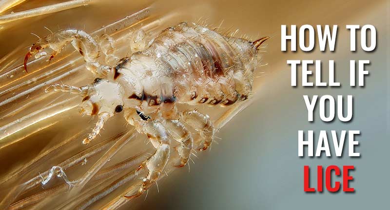 How To Tell If You Have Lice: Pay Attention To These 5 Signals!