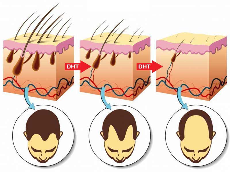 Does Creatine Cause Hair Loss? Muscles Or Hair? 