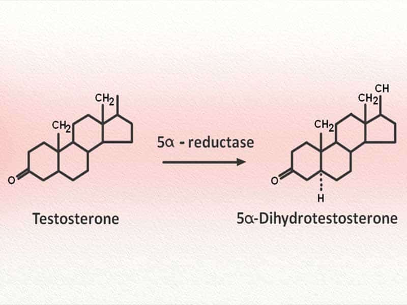 What Is DHT And Its Close Relation With Hair Loss | Lewigs