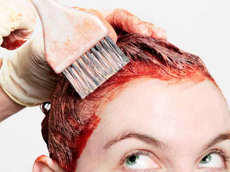 Myth Busting: Itchy Scalp And Hair Loss - How Are They Related?