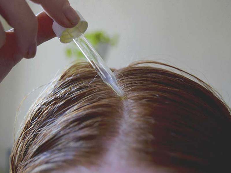 Minoxidil For Hair Loss Secrets That No One Else Knows About