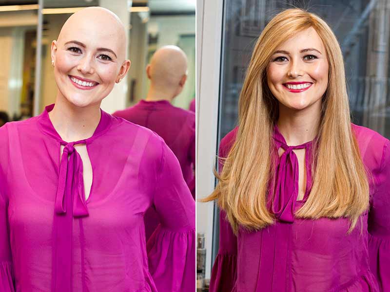 wigs for cancer patients charity