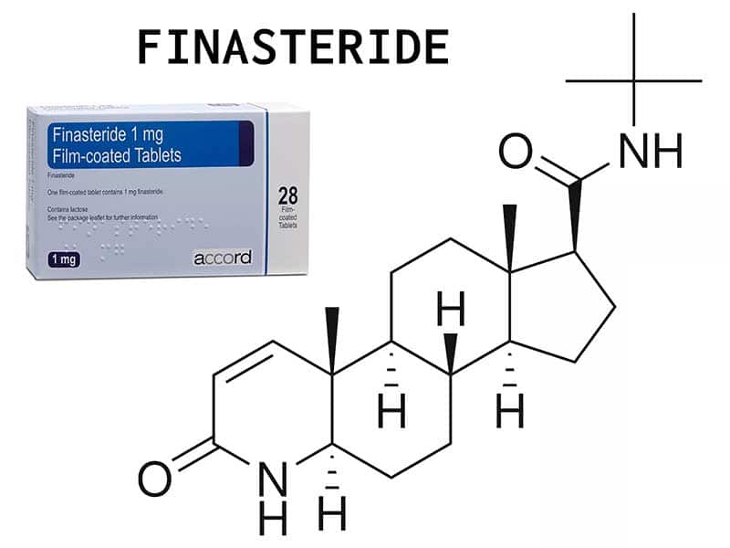 The Hidden Truth On Finasteride For Hair Loss Exposed