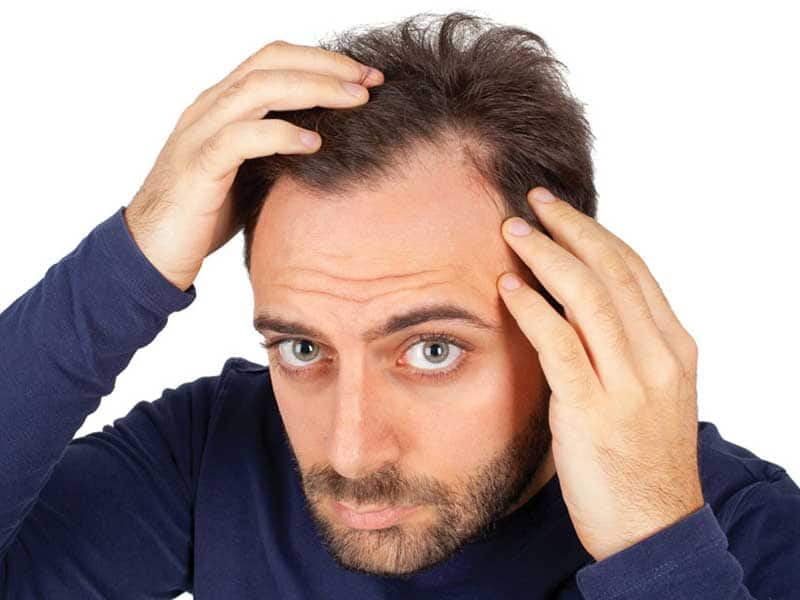 Signs Of Balding - How To Know If You're Going Bald?