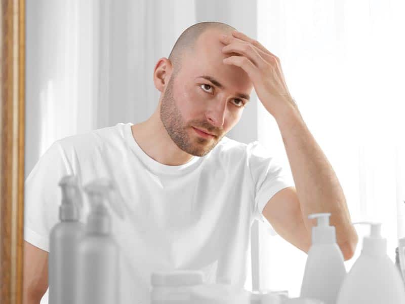 Signs Of Balding - How To Know If You're Going Bald?