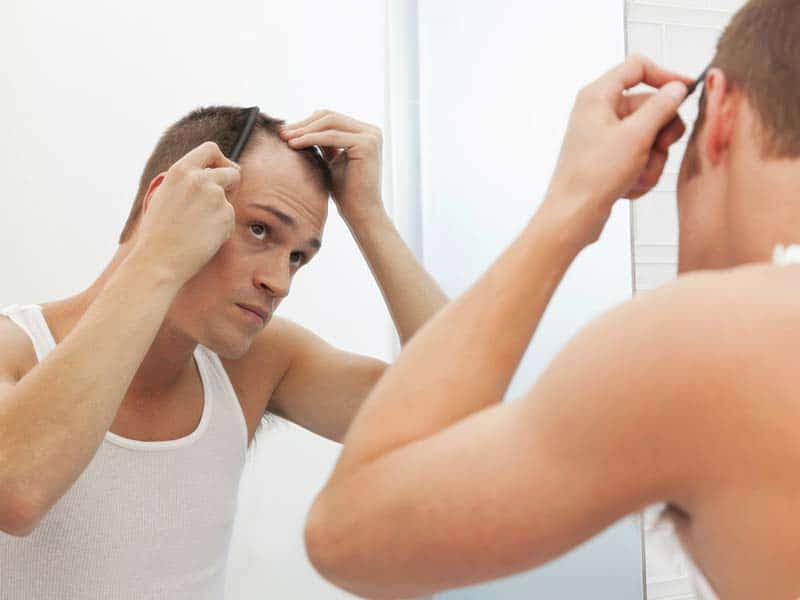 Signs Of Balding At 20: Are You Caught With Any?