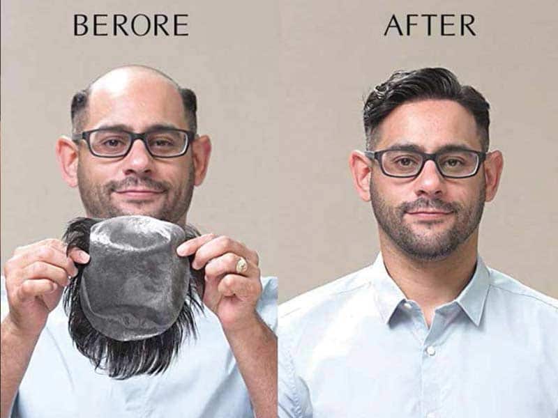 Why It's Easier To Fail With Bald Wig Than You Might Think
