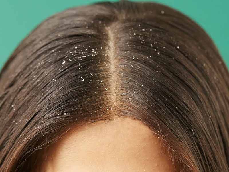 Get The Scoop On White Vinegar For Hair Before You're Too Late