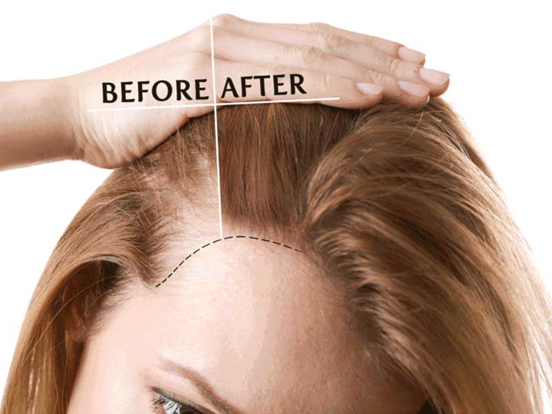 Collagen For Hair - Are You Prepared For A Good Thing?