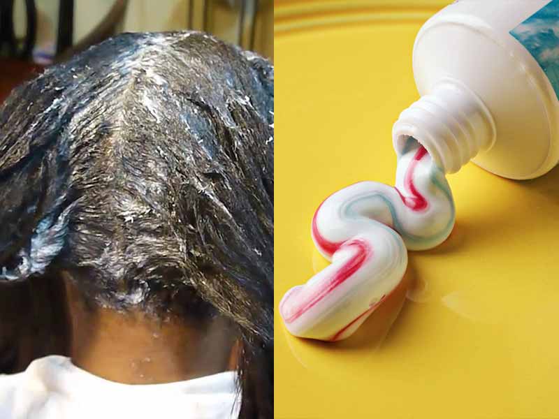 How To Remove Hair Dye From Scalp? - 7 Easy Hacks! - Lewigs