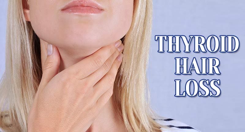 The Fundamentals Of Thyroid Hair Loss Revealed