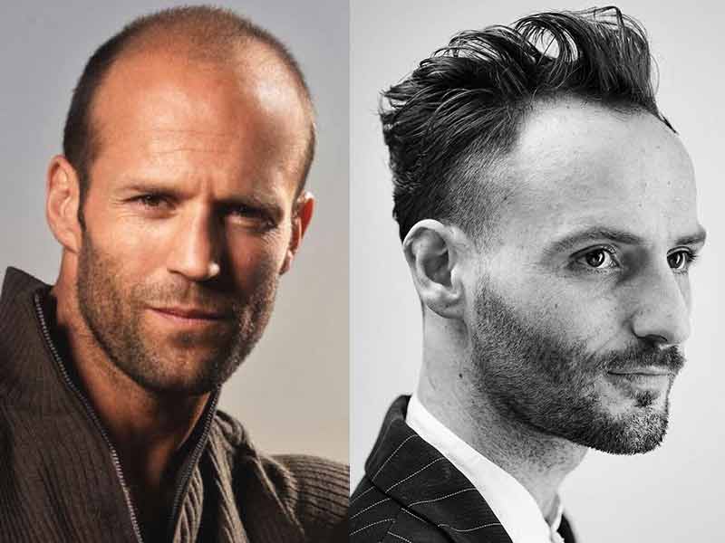 11 Hairstyles For Men With Thin Hair And Big Forehead Lewigs