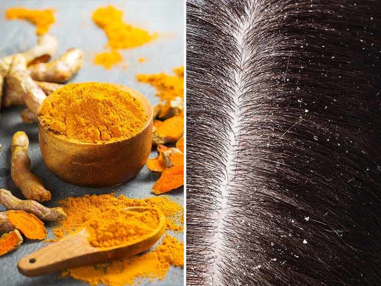 Turmeric For Hair Growth: Benefits & Usage - Lewigs