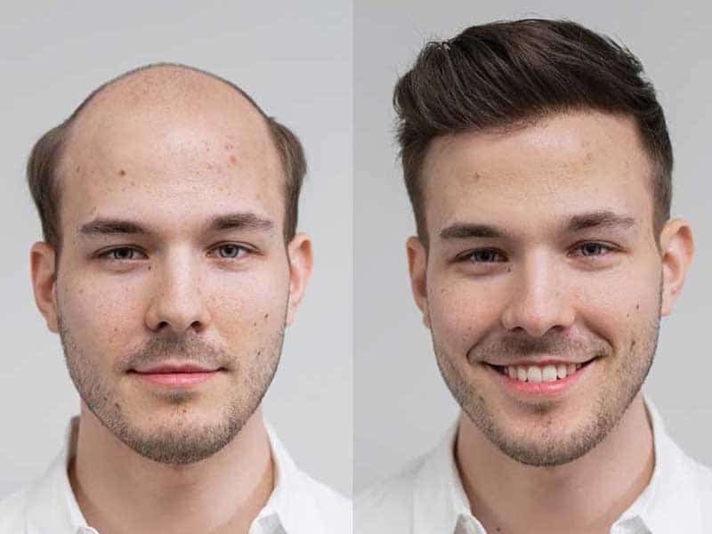 Most handsome bald men