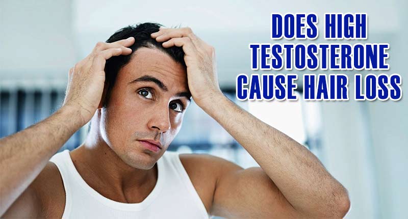 Does High Testosterone Cause Hair Loss? It Really Does!