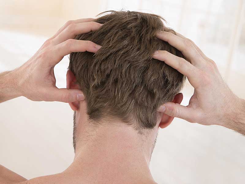 Itching Feeling When Wearing Hair System? Problems & Solutions