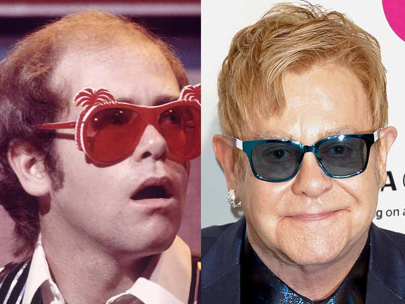 Elton John Toupee - It's No Longer A Rumor!