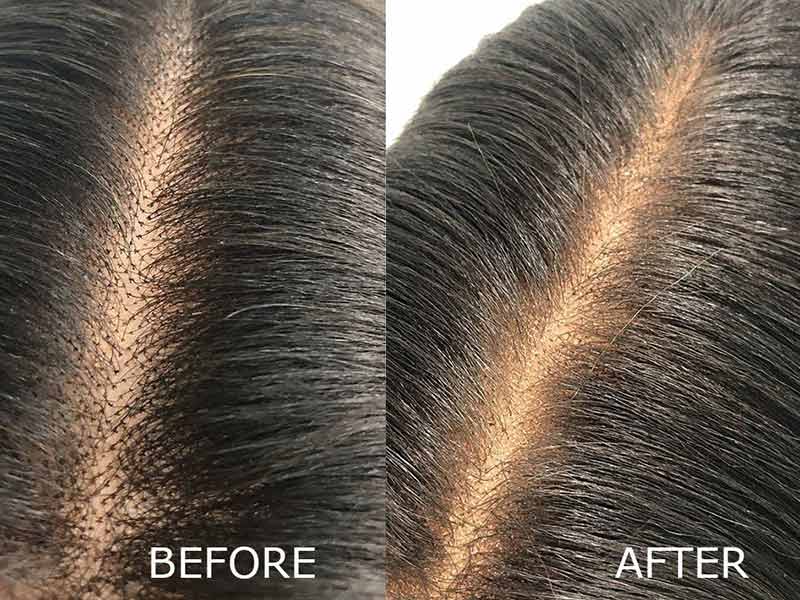 How To Make A Lace Closure From Scratch? - An Expert’s Guide