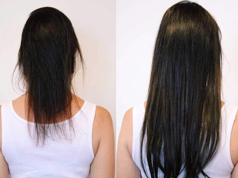 The Brand-New Idea On How To Hide Scalp With Thin Hair