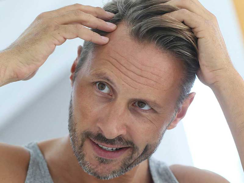 The Forbidden Truth About Mature Hairline Revealed By An Old Pro