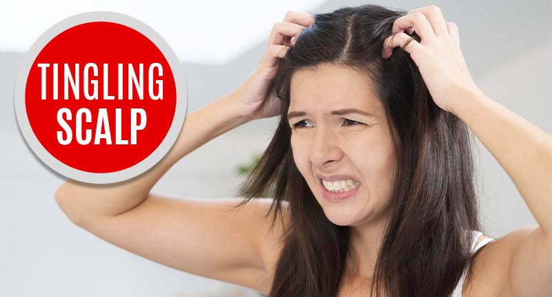 Tingling Scalp: Reasons & Solution - How To Stop This Nightmare