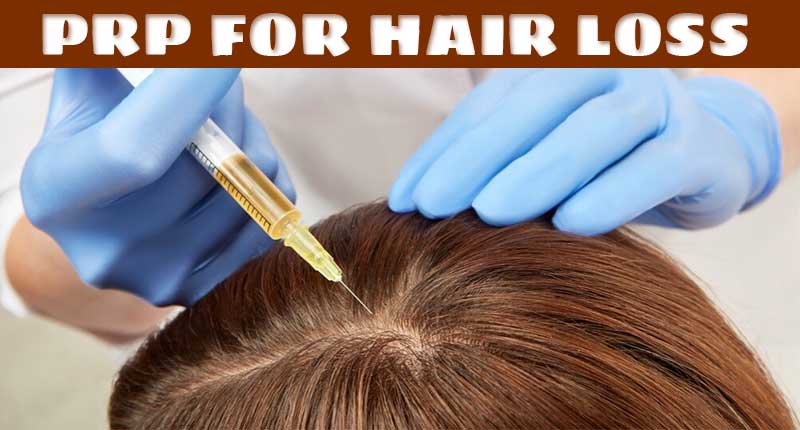 Heard About PRP for hair loss? It's An Incredible Method To Try