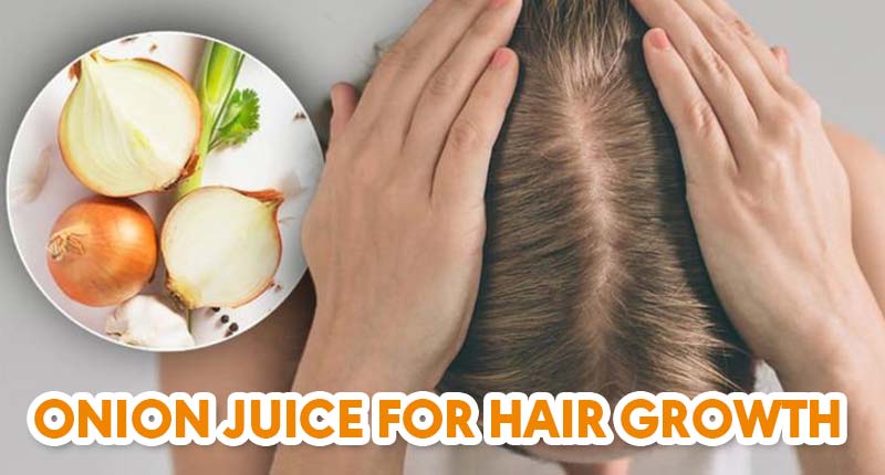 People Are Trying Onion Juice For Hair Growth - There's Must Be Something...