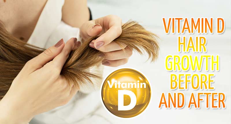 Vitamin D Hair Growth Before And After - Does It Really Help?