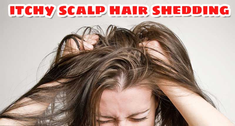 Itchy Scalp Hair Shedding - Are They Related?